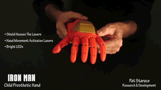iron-man-hand-prosthetic-2