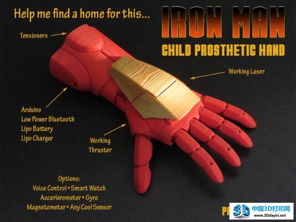 iron-man-hand-prosthetic-3