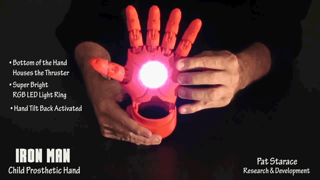 iron-man-hand-prosthetic-1
