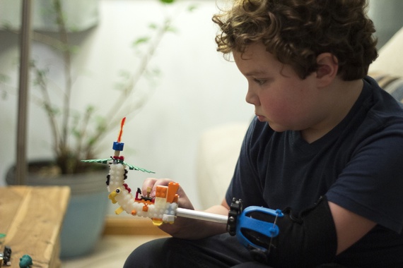 boy-3d-printed-prosthetic-hand-2