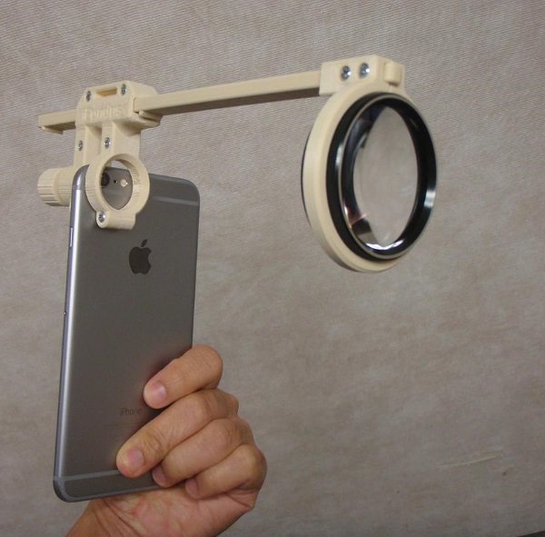 医生使用3D打印和智能机开发出眼部诊断器 医生使用3D打印和智能机开发出眼部诊断器