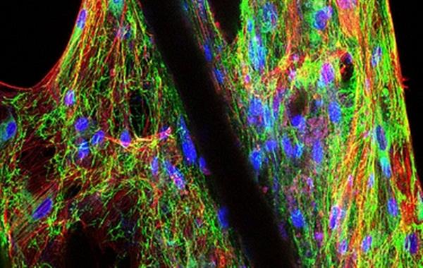 慕尼黑工业大学开发关节软骨生物3D打印技术 慕尼黑工业大学开发关节软骨生物3D打印技术