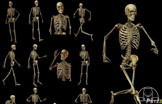 3d打印技术实现骨科手术私人定制 3d打印技术实现骨科手术私人定制