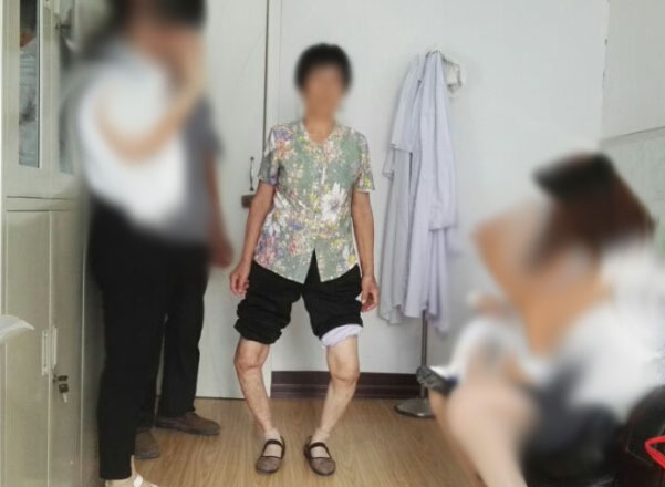冀中能源峰峰集团总医院邯郸医院关节置换3D打印“私人订制” 冀中能源峰峰集团总医院邯郸医院关节置换3D打印“私人订制”