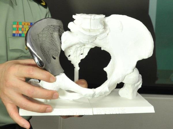 Gartner发布最新3D打印报告:医疗产业增长显著 生物产业将成主流 Gartner发布最新3D打印报告:医疗产业增长显著 生物产业将成主流