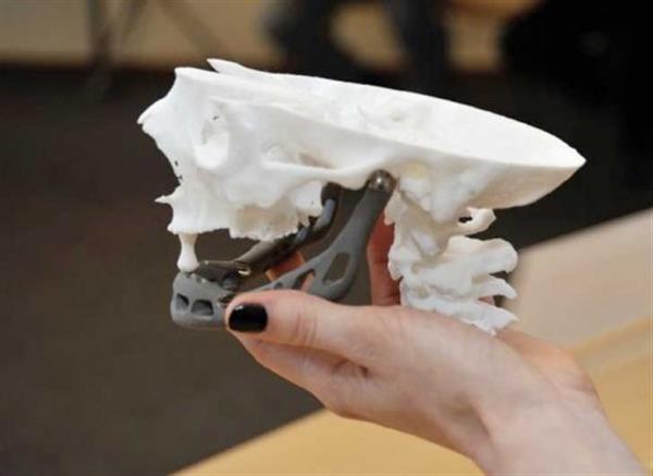 Gartner发布最新3D打印报告:医疗产业增长显著 生物产业将成主流 Gartner发布最新3D打印报告:医疗产业增长显著 生物产业将成主流