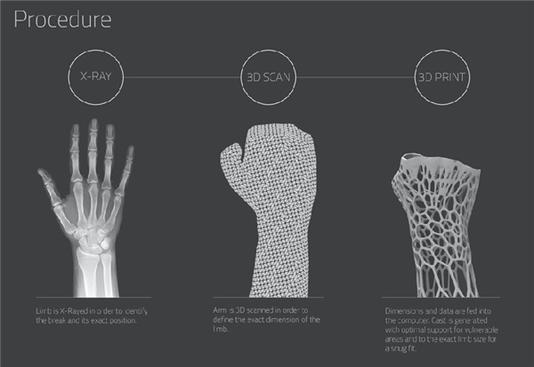 Gartner发布最新3D打印报告:医疗产业增长显著 生物产业将成主流 Gartner发布最新3D打印报告:医疗产业增长显著 生物产业将成主流