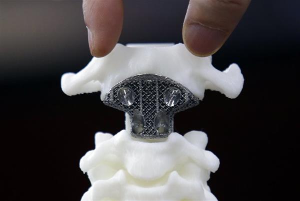 Gartner发布最新3D打印报告:医疗产业增长显著 生物产业将成主流 Gartner发布最新3D打印报告:医疗产业增长显著 生物产业将成主流