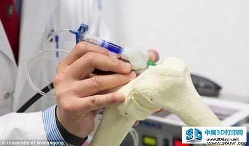 类似3D打印 新科技可“画”出骨骼组织