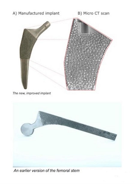 MicGill大学推出接近天然骨的多孔3D打印骨骼植入物