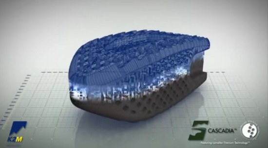 K2M宣布将在美国首推3D打印钛脊柱解决方案