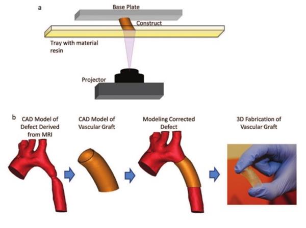 科学家使用3D打印血管植入物治疗先天性心脏病