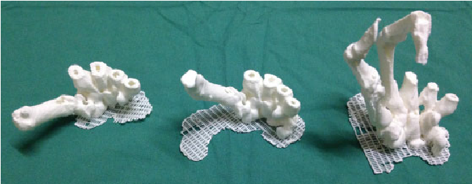 3D printed haptic models representing carpal and metacarpal bones during various hand movements: abduction (left), opposition (center), and key pinch (right)