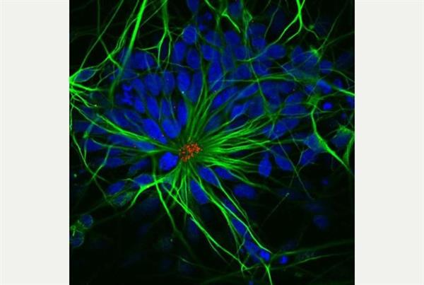 aston-university-s-3d-printed-meso-brain