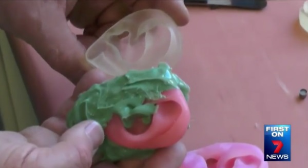 澳洲整形外科医生为患者3D打印硅胶耳朵假体