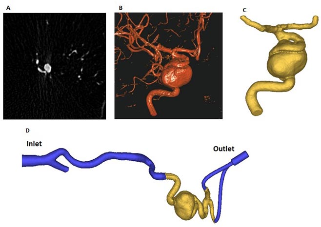 vascular-simulation-stratasys