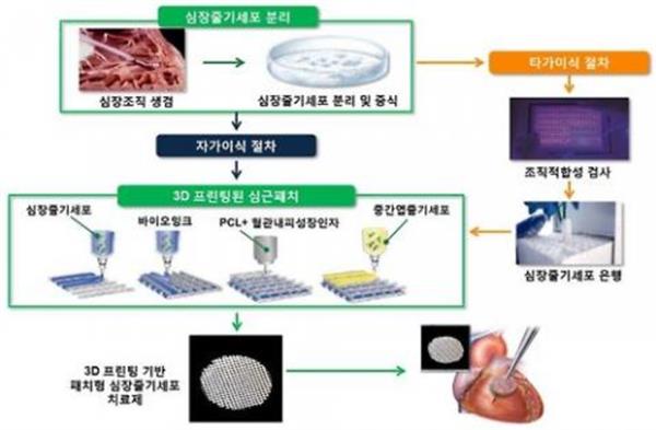 韩国研究人员推出治疗缺血性心脏病的3D打印心肌补片
