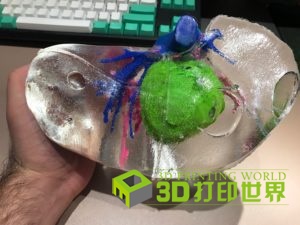 3D-printed-liver-model-300x225.jpg